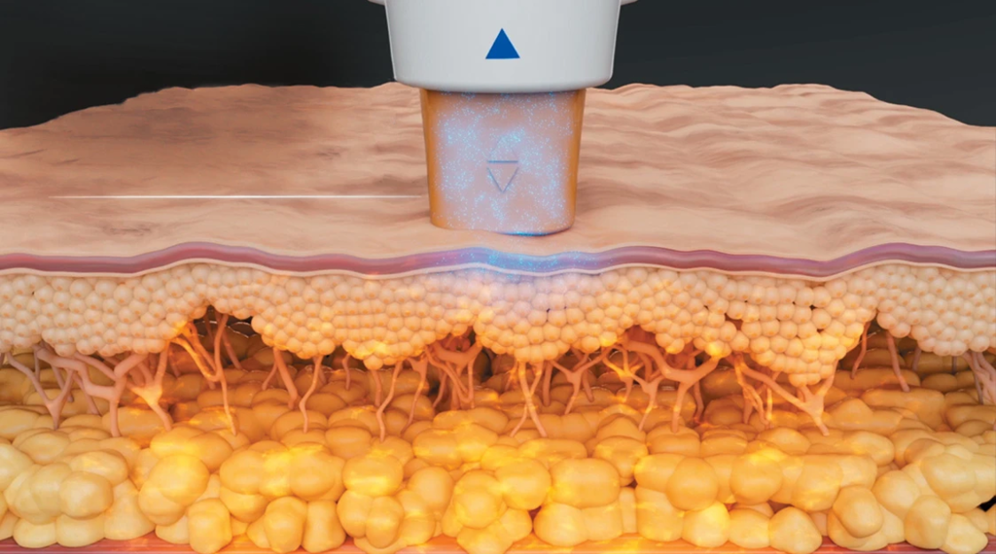 kuidas see toimib foto